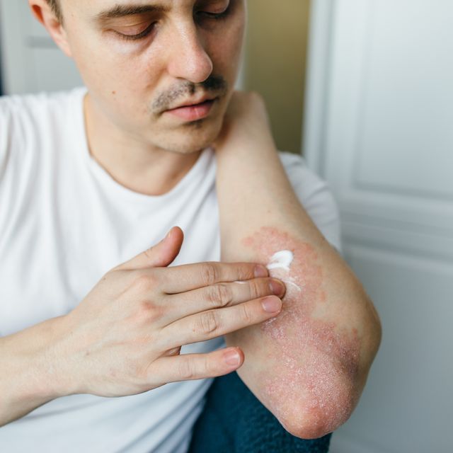 د پوستکي حساسیت ډولونه