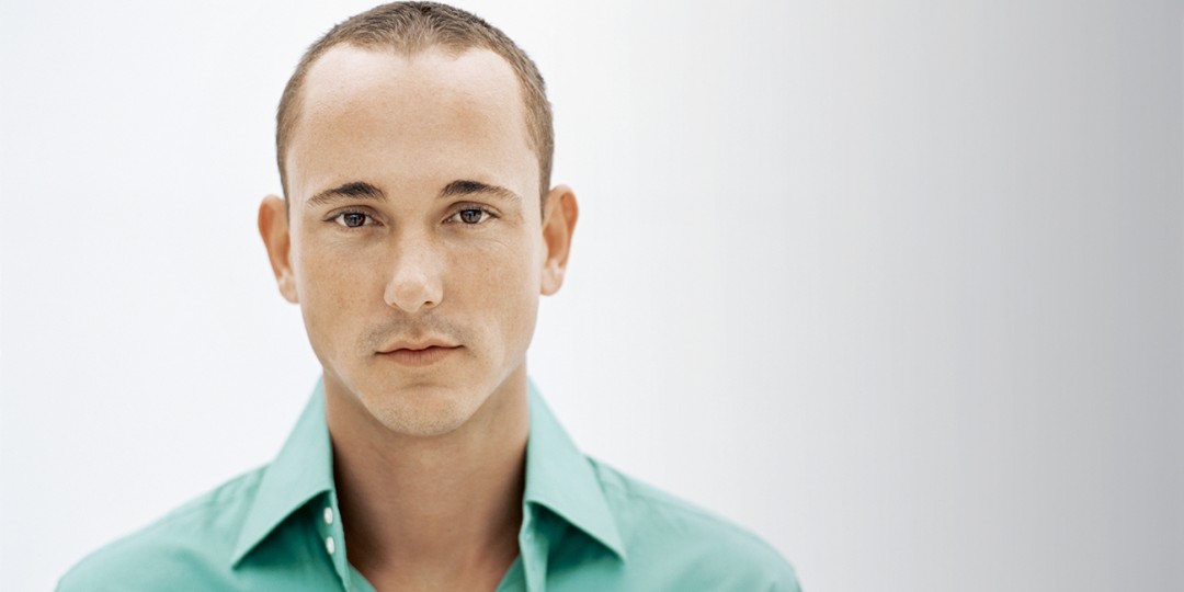 ریزش موی مردانه (Male Pattern Hair Loss)