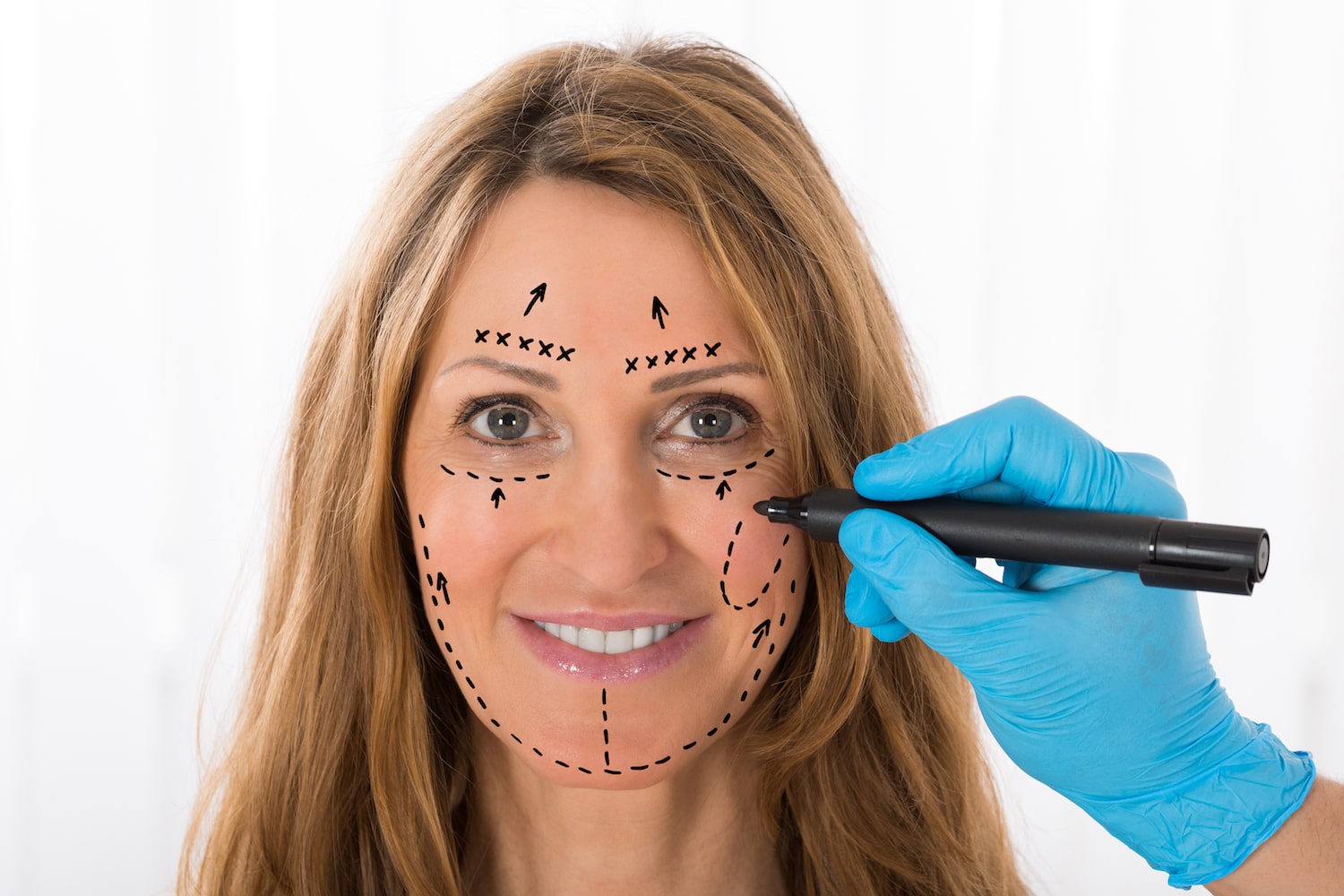 فیس‌لفت (Facelift) – بهترین روش جراحی برای جوان‌سازی صورت و گردن در کابل