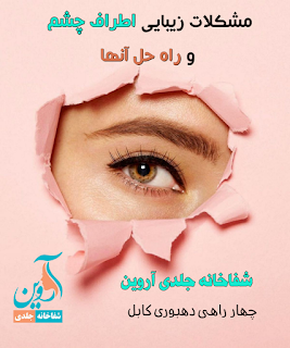 زیبایی چشم‌ها