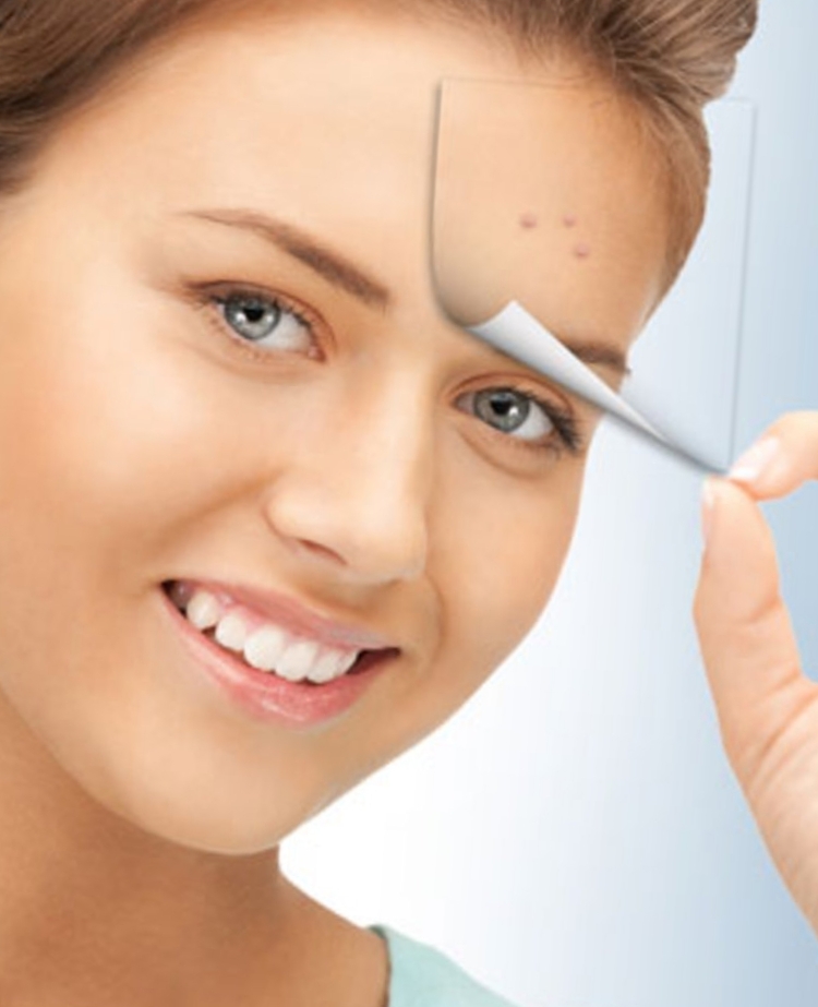  تداوی بخار روی یا جوانی دانه در شفاخانه جلدی آروین کابل