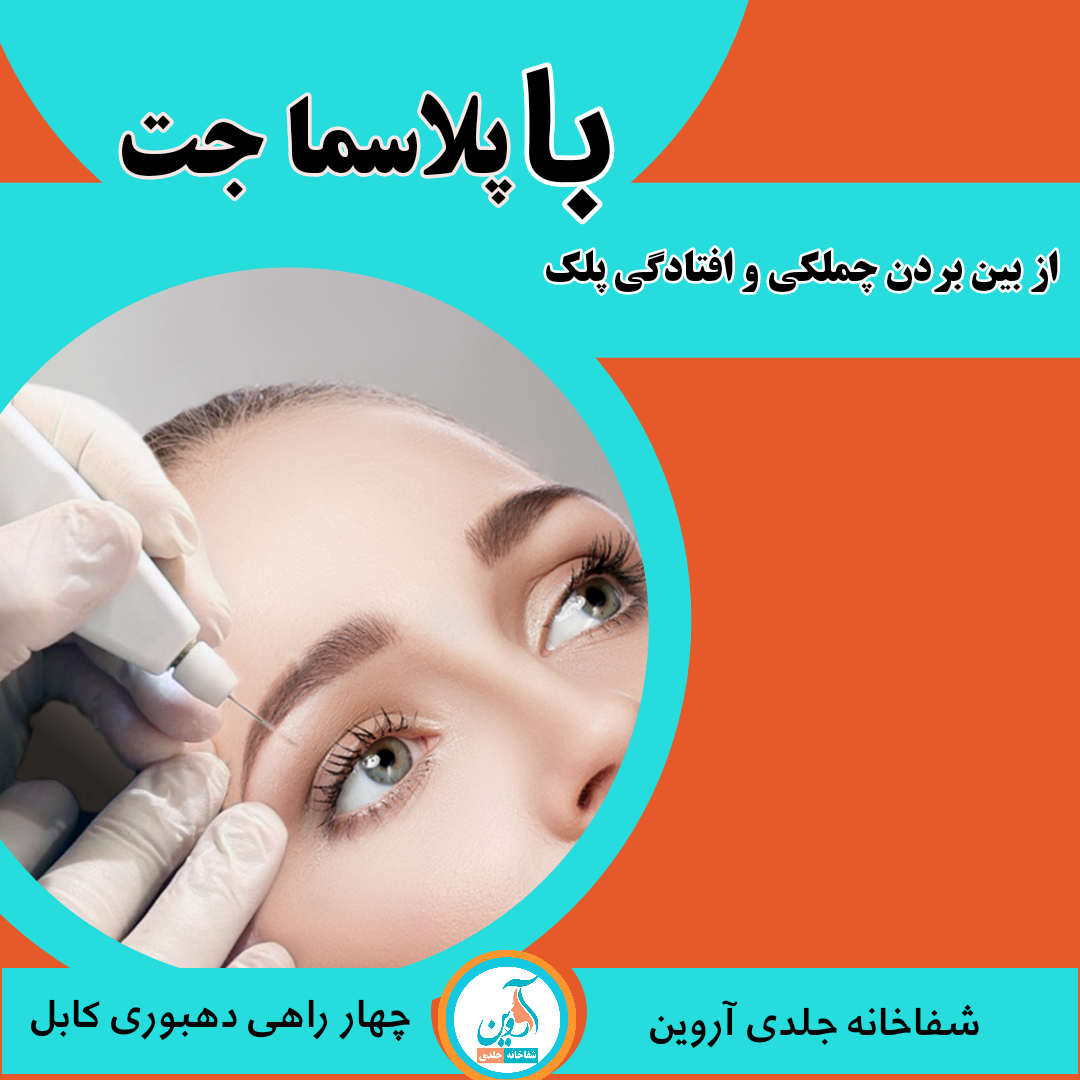 پلاسما جت: روش مدرن رفع افتادگی پلک و چروک دور چشم پلاسما جت یکی