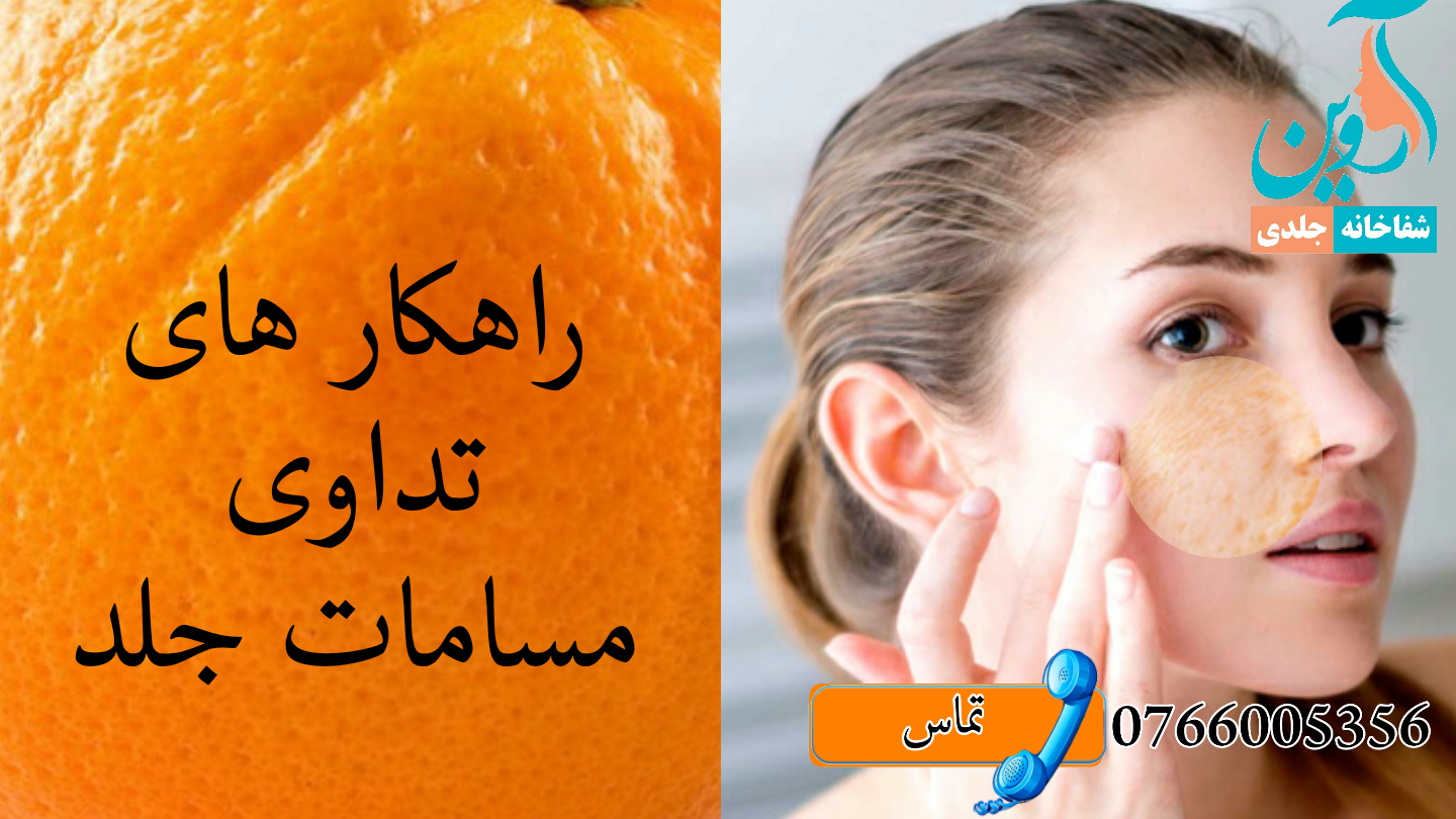 مسامات یا منافذ باز جلد