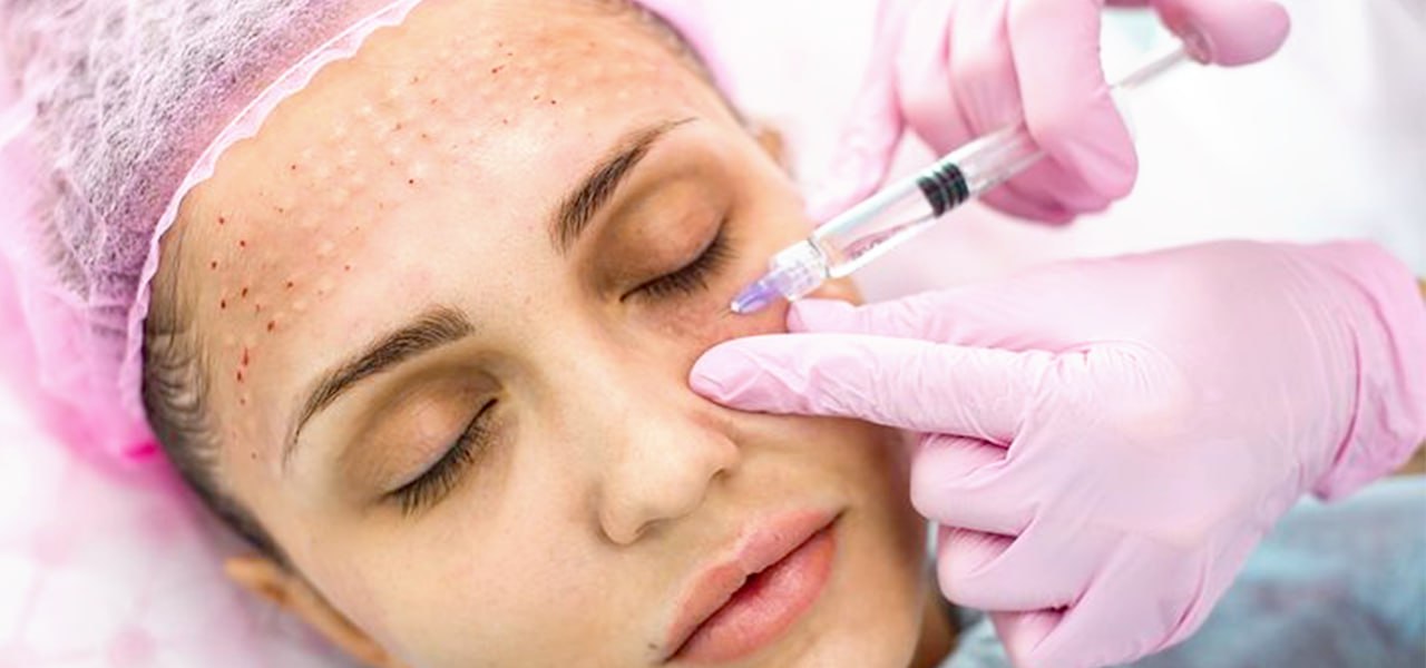 پروسیژر های جلدی زیبایی 