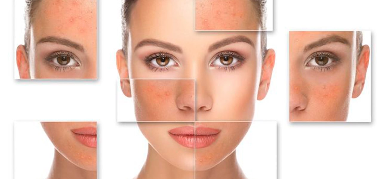 تشخیص و تداوی امراض جلدی 