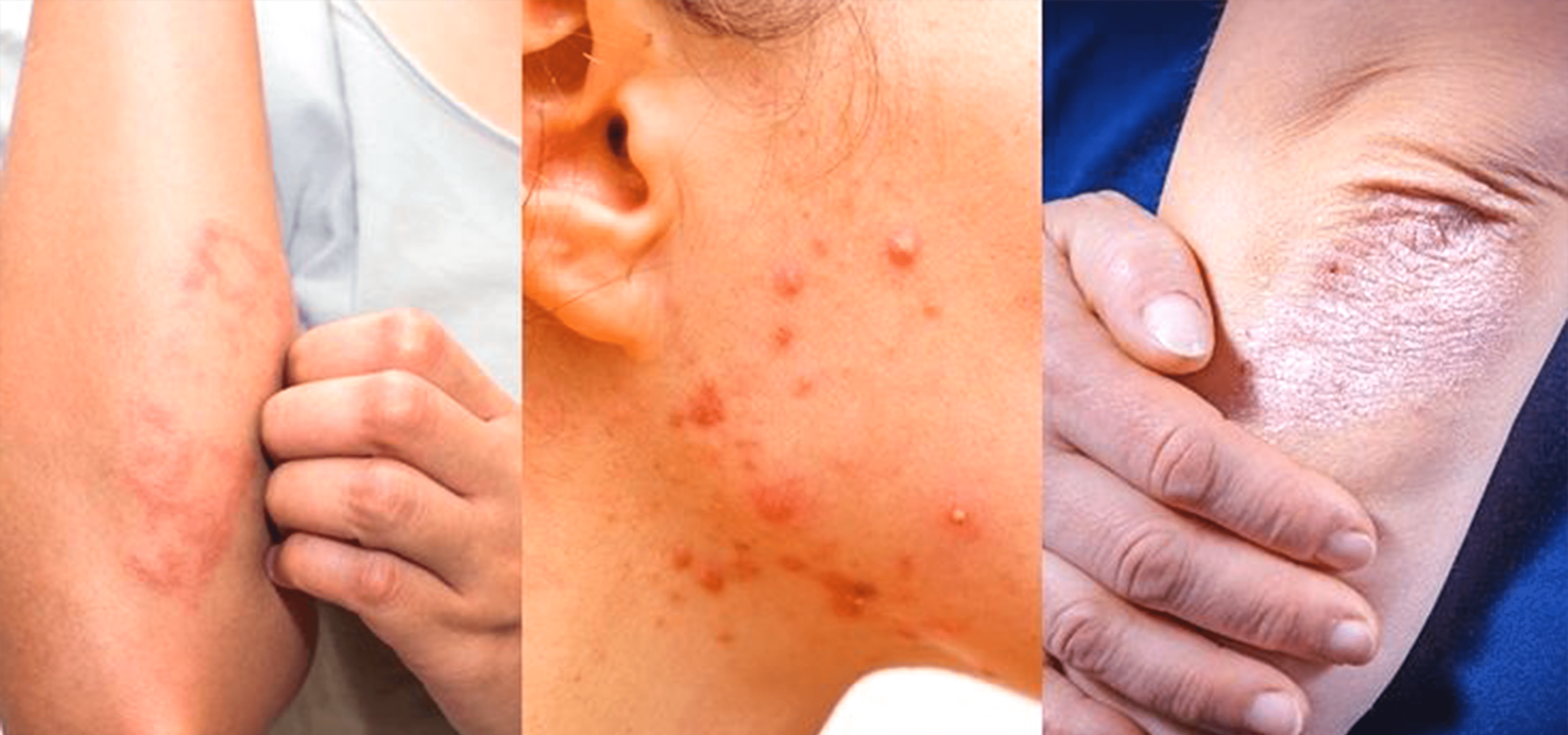 تداوی تخصصی امراض جلدی 