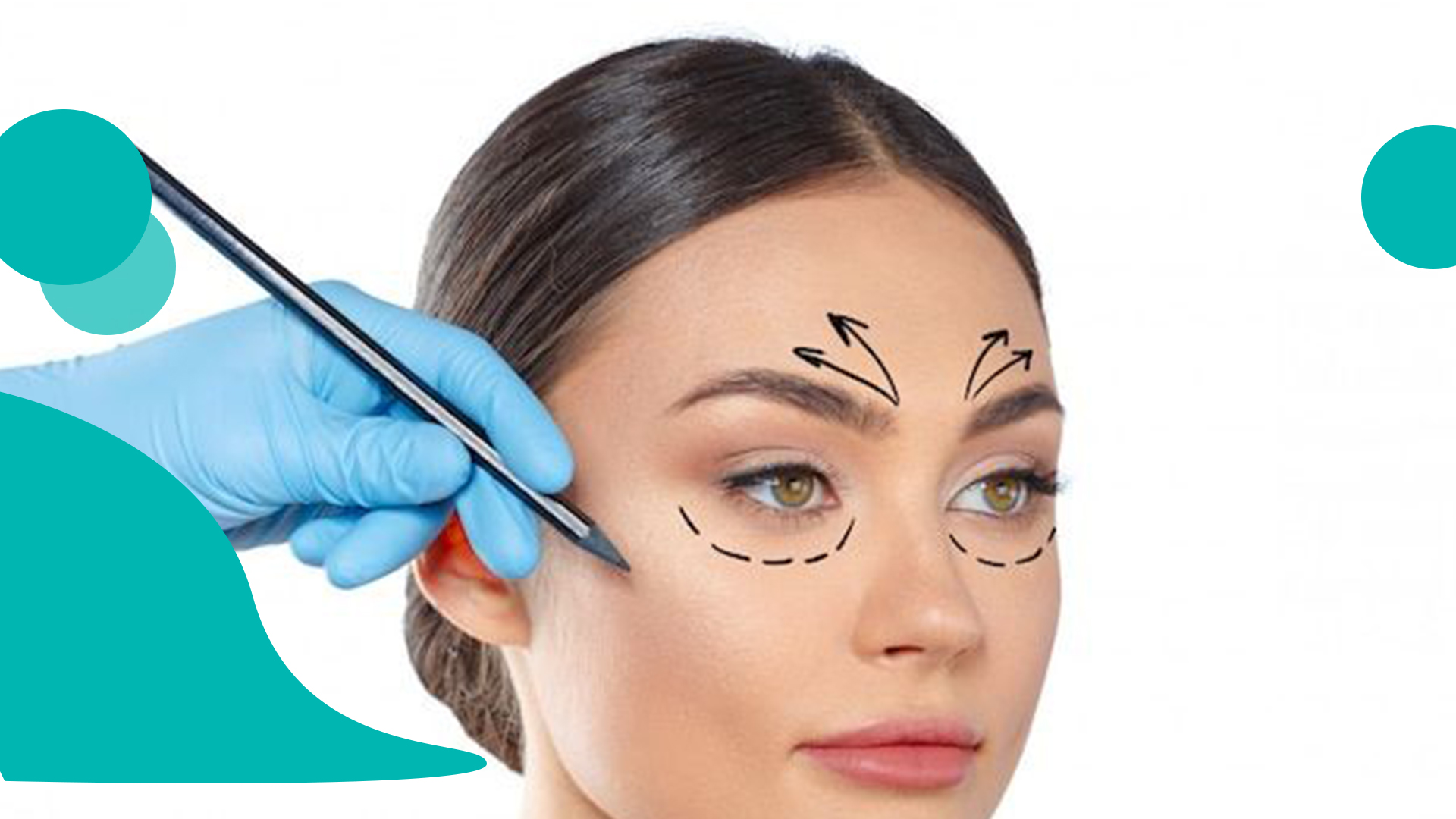 جراحی زیبایی چشم 