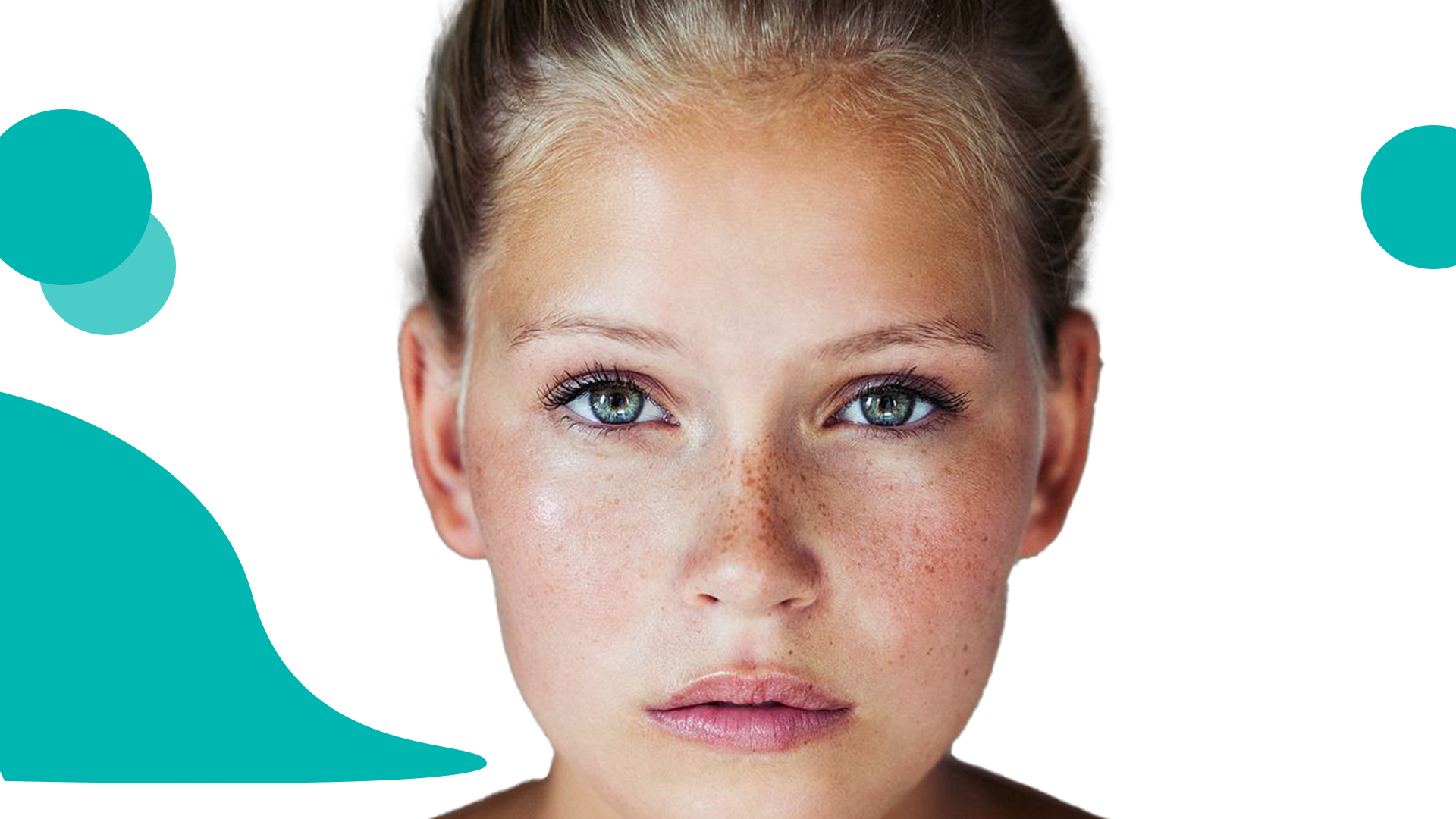 تداوی لکه های مگسی یا کنجتک