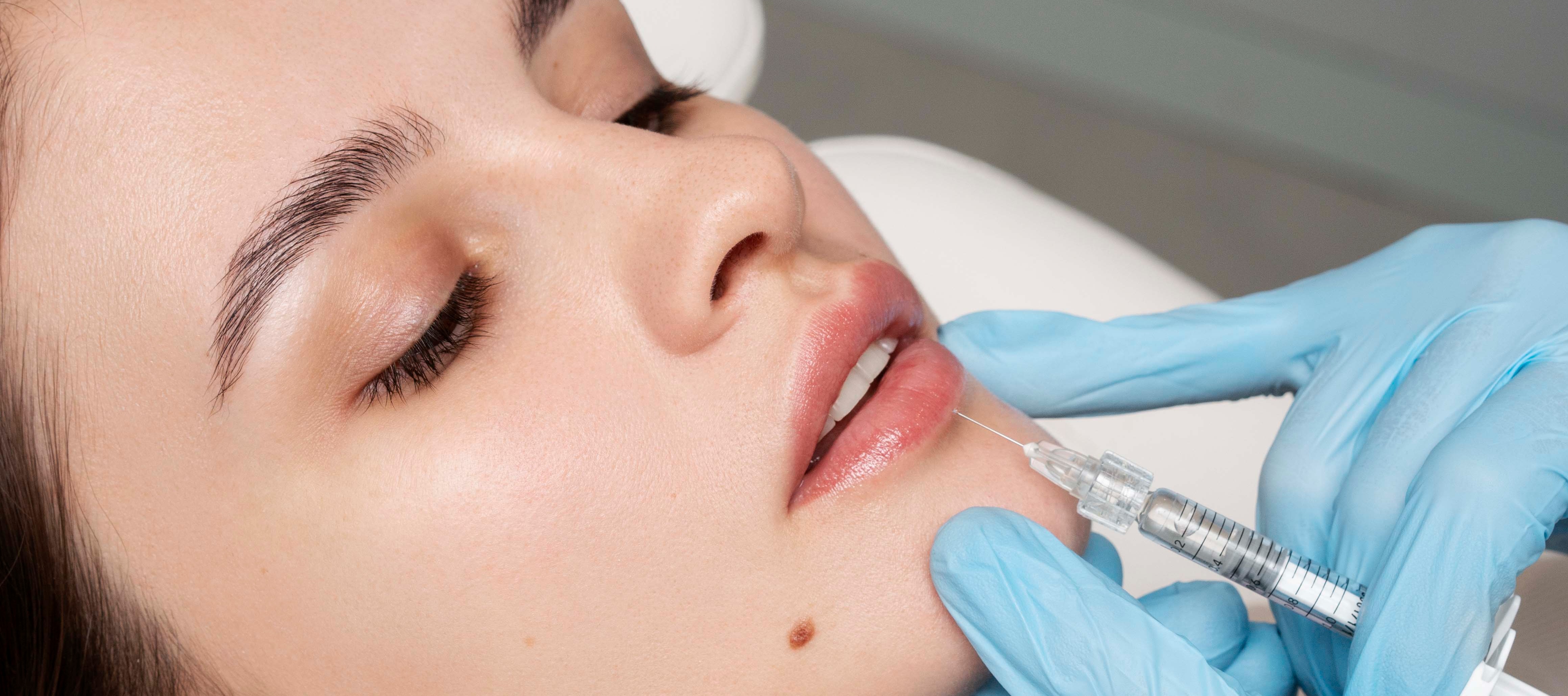 Lip filler in Arvin 